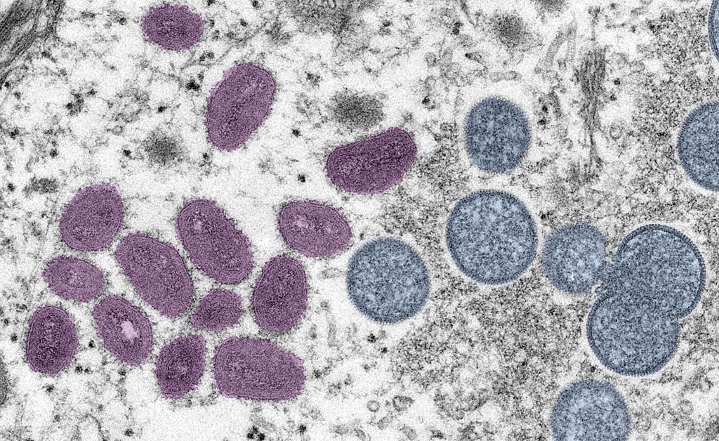 A digitally colorized electron microscopic (EM) image depicting a monkeypox virion (virus particle), obtained from a clinical sample associated with a 2003 prairie dog outbreak, published June 6, 2022. The image depicts a thin section image from a human skin sample. On the left are mature, oval-shaped virus particles, and on the right are the crescents and spherical particles of immature virions