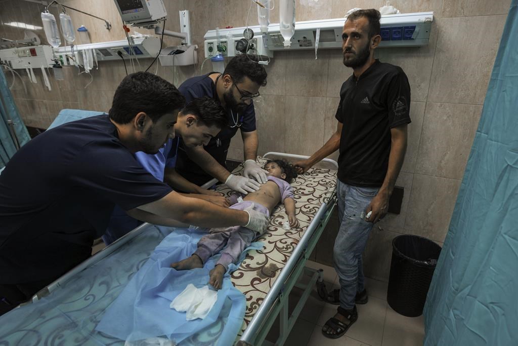 Gaza hospitals are overwhelmed with patients and desperately low on supplies as invasion looms | CityNews Calgary