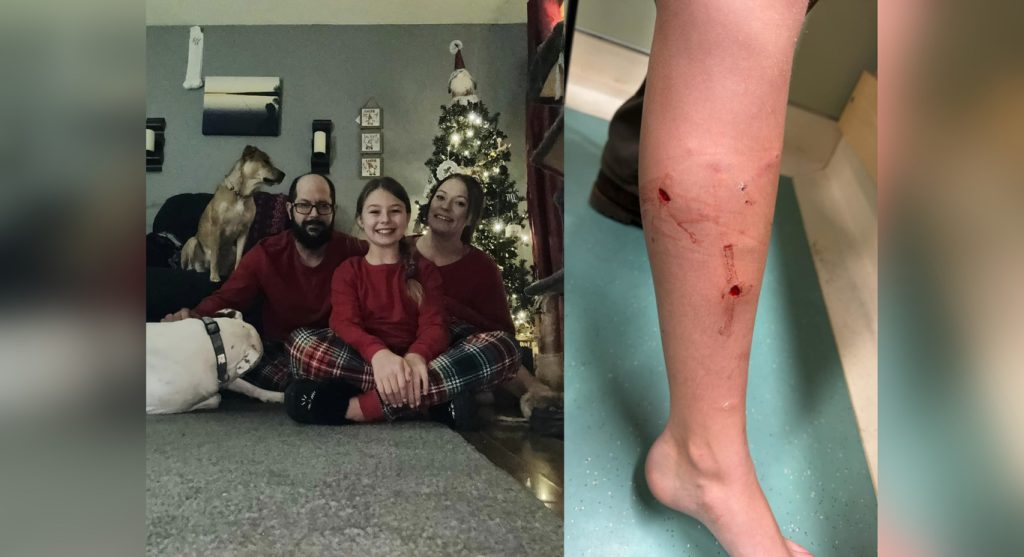 https://calgary.citynews.ca/wp-content/blogs.dir/sites/8/2023/12/28/Nygard-family-and-the-wound-a-girl-suffered-from-a-coyote-1024x557.jpg