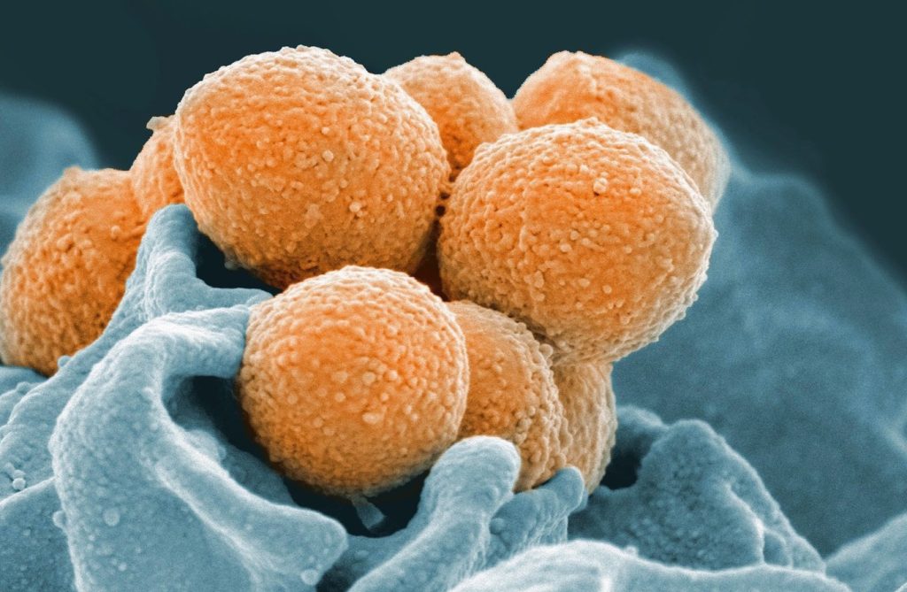 This handout image provided by the National Institute of Allergy and Infectious Diseases shows an electron microscope image of Group A Streptococcus (orange) during phagocytic interaction with a human neutrophil (blue). THE CANADIAN PRESS/AP-National Institute of Allergy and Infectious Diseases via AP