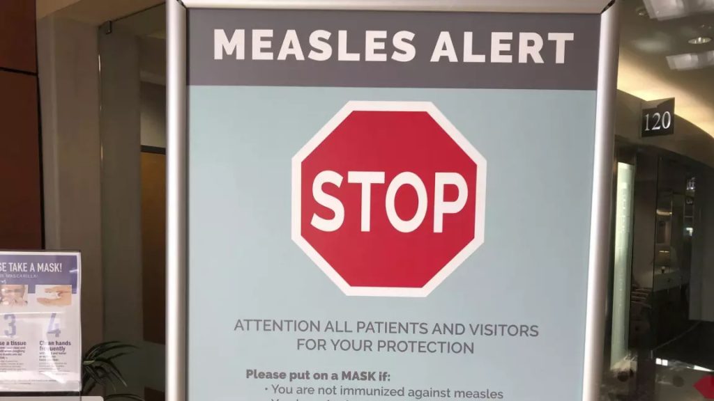 AHS confirms first case of measles in Alberta this year