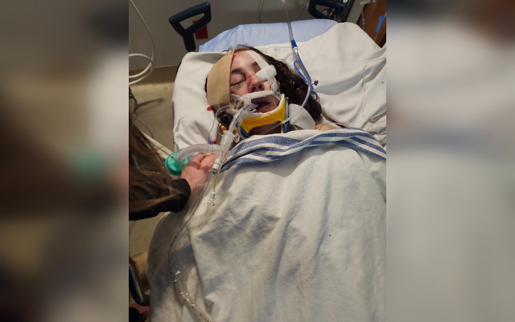 Calgary family seeking support as teen recovers from hit-and-run