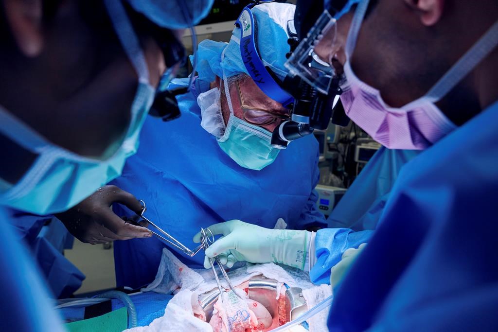 Doctors combine a pig kidney transplant and a heart device in a bid to extend woman's life