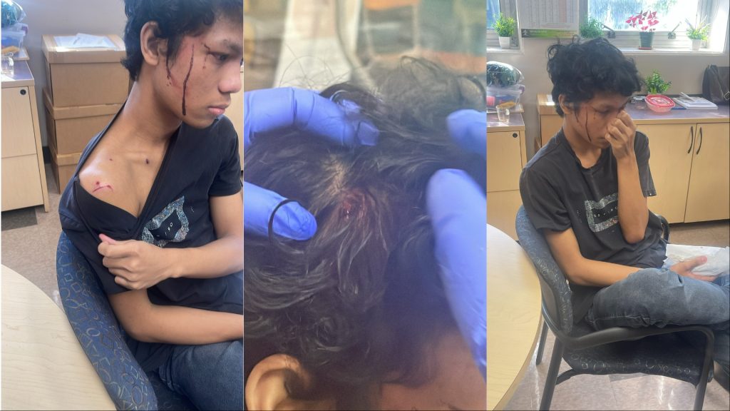 Calgary teen new to Canada recovering after being attacked by group of students