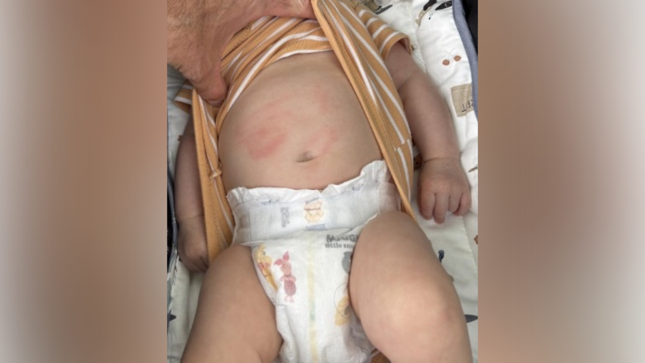 Calgary Police Seek Youth Suspect After Alleged Assault on 9-Week-Old Baby